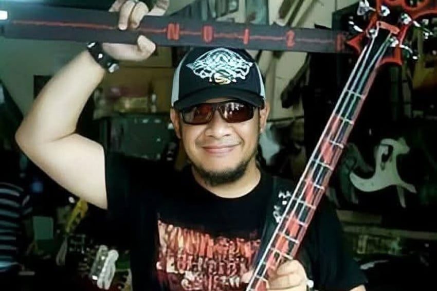 Trisno Pas Band Abaikan Kaki Bengkak sebelum Divonis Gagal Ginjal Kronis